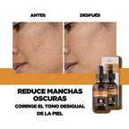 Brightening Vitamin C Serum – Improves Dark Spots & Uneven Skin Tone (30ml)